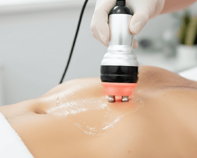 Radiofrecuencia Corporal