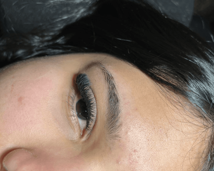 capping megavolumen brasilero 8d