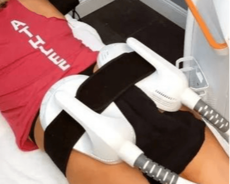 RENA ESCULPT FE80 1 ZONA