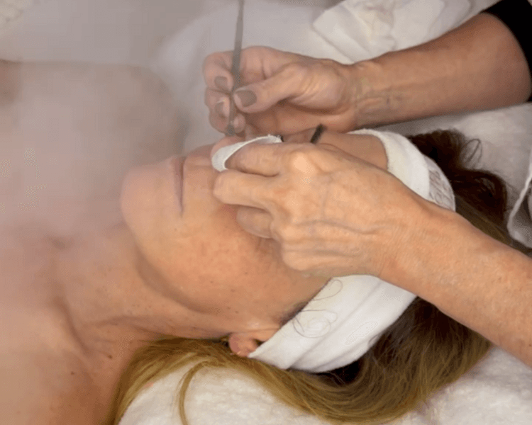 Higiene Facial Profunda con Dermaplaning