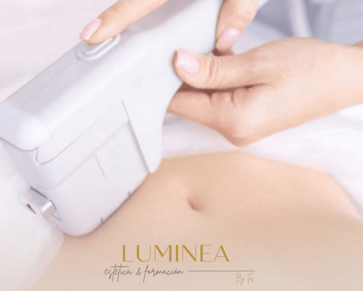 RF MICRONEEDLING + EXOSOMAS - 1 zona