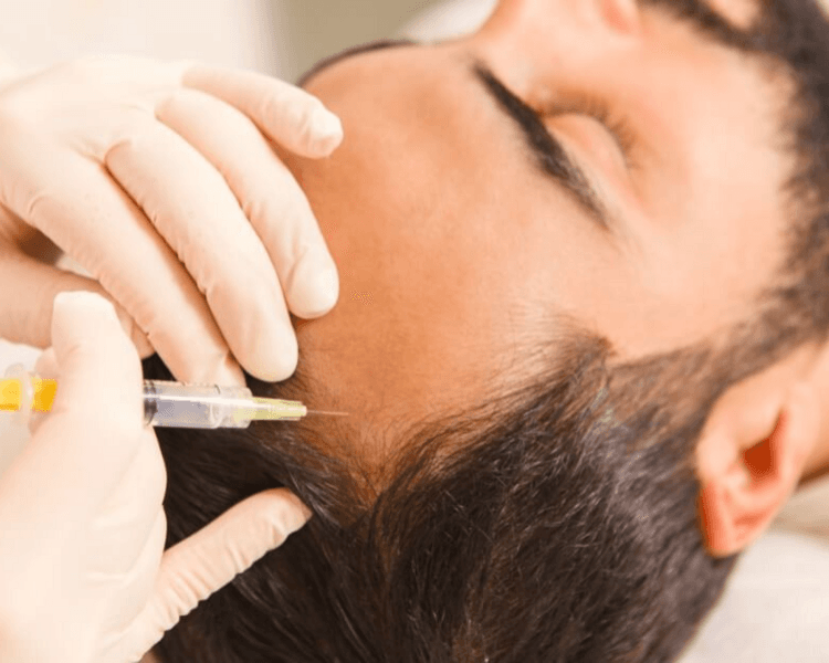 MESOTERAPIA, CARBOXITERAPIA Y LÁSER