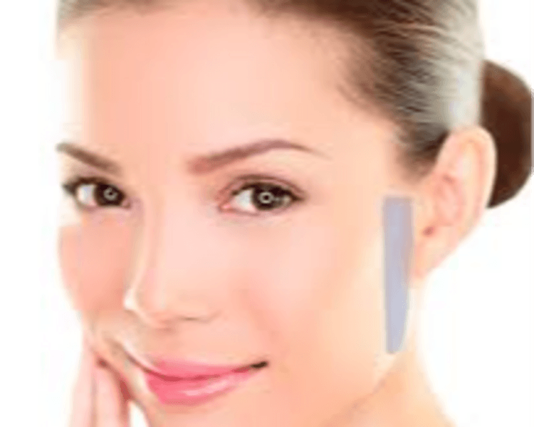 DEPILACIÓN LÁSER XS - MUJER