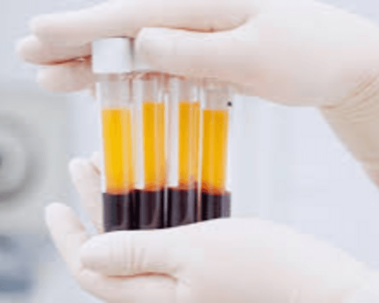 Plasma rico en plaquetas Facial