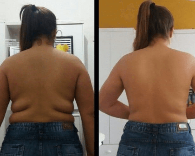 MASAJE REDUCTIVO (MANUAL)