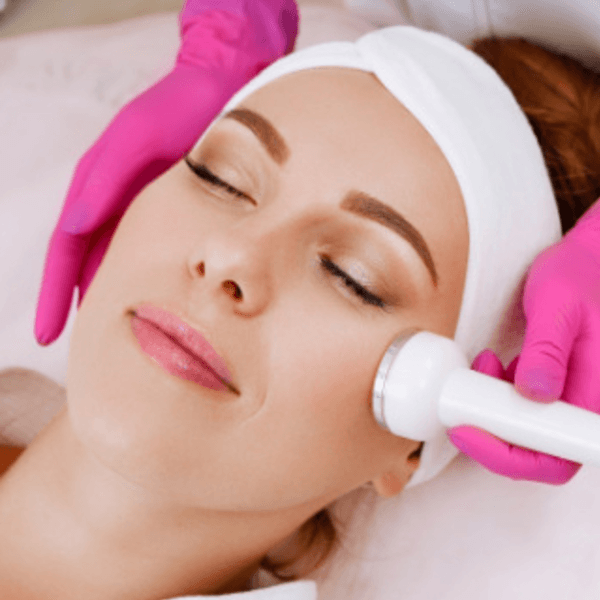 Rejuvenation-Pulses, Acne, Expression lines (1 session, 200 shots)/Rejuvenecimiento-Manchas, Acné, Líneas de expresión (1 sesion 200 Disparos)