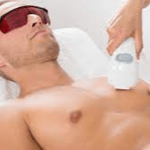 Depilación Láser en Pectorales Hombre