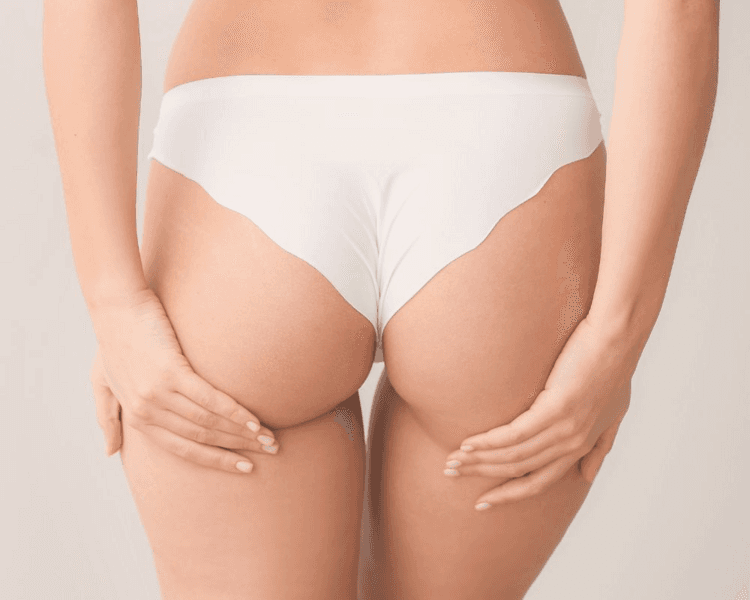 Endopeel (levanta tu gluteos)