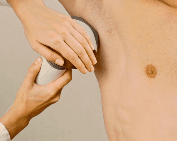 Depilacion Definitiva ZONAS MEDIANAS