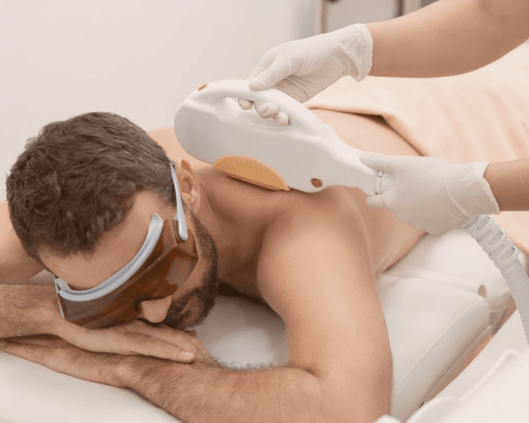 Depilacion Definitiva: Linea Alba