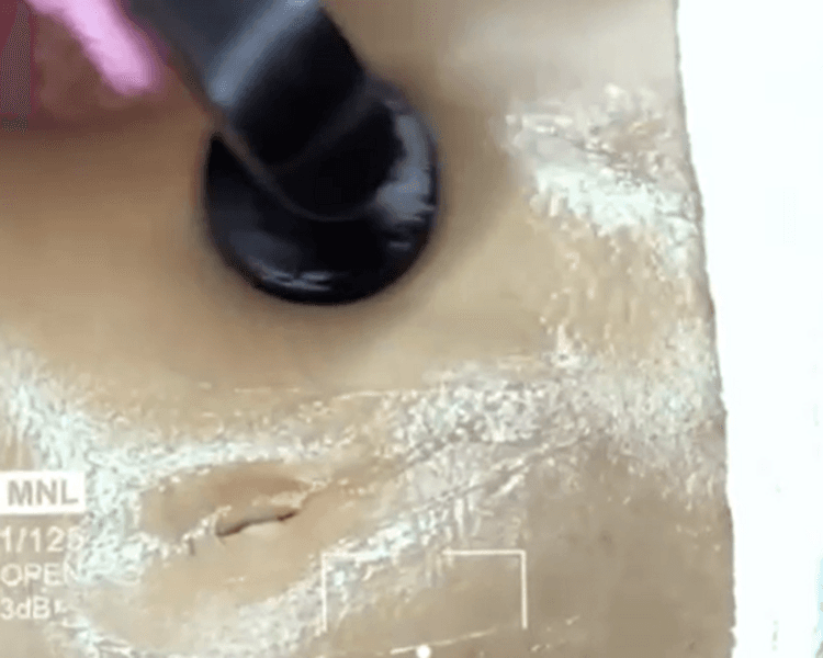 Tratamiento reafirmante con aparatología 1 sesión