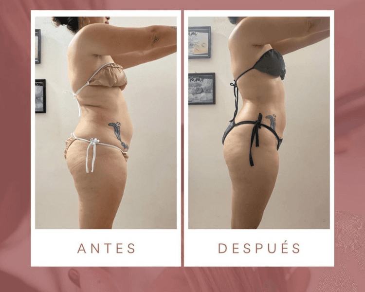 PAQUETE CUERPO COMPLETO 8 SESIONES
