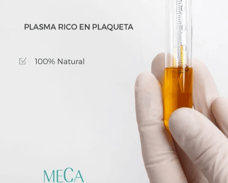 Plasma Rico en Plaquetas Capilar