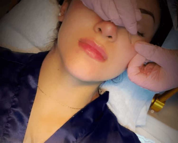 Limpieza facial + limpieza capilar + drenaje linfático