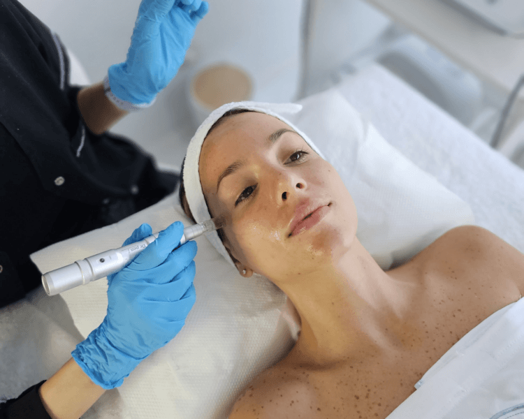 EXO-LIFT (EXOSOMAS EN ROSTRO+PAPADA+CUELLO X 4 SESIONES)