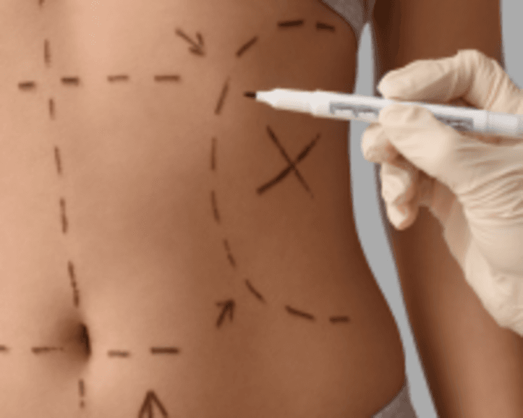 Masaje Post-Lipoescultura