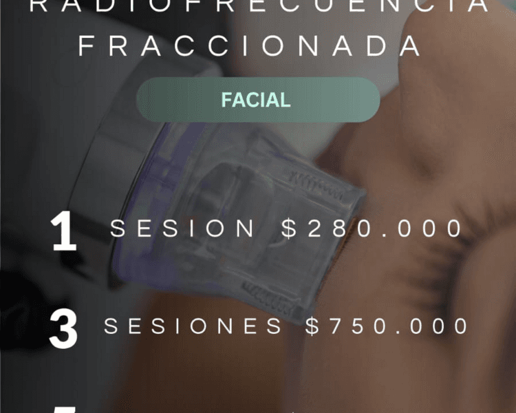 RADIOFRECUENCIA FRACCIONADA FACIAL