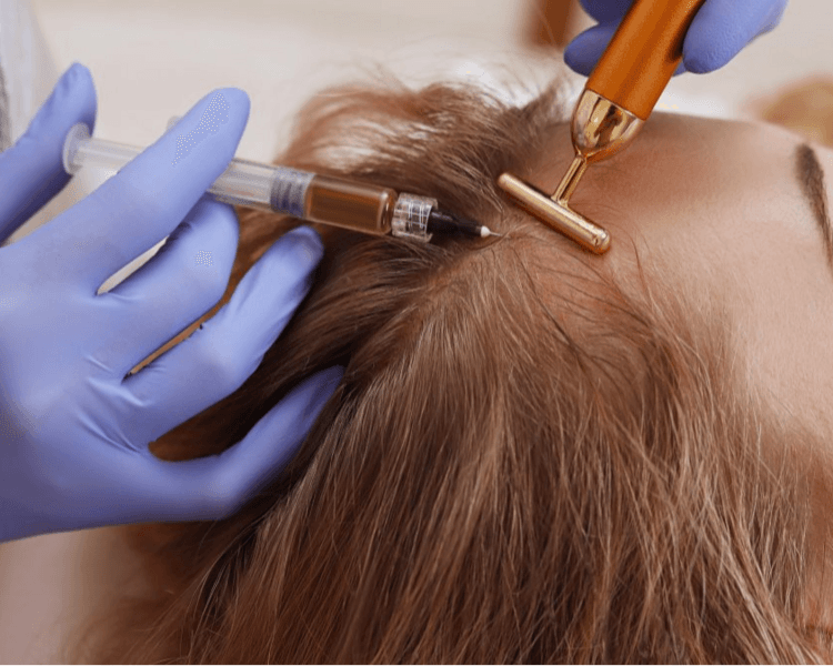 MESOTERAPIA CAPILAR + ALTA FRECUENCIA