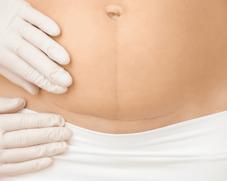 Post Parto - 10 sesiones