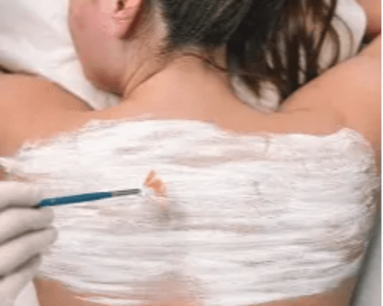 Limpieza Profunda Espalda