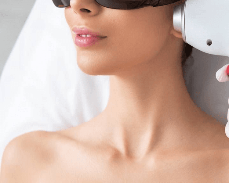 Bozo + Mentón + Mejillas + Patillas.