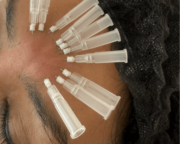 Malla de 20 hilos revitalizantes