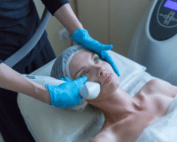 Depilación OPT Cara Completa