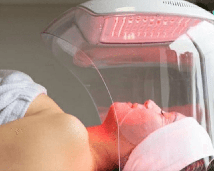 HIGIENE FACIAL PROFUNDA + PEELING