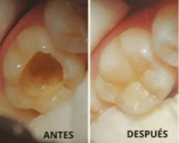 Operatoria /Odontologia General