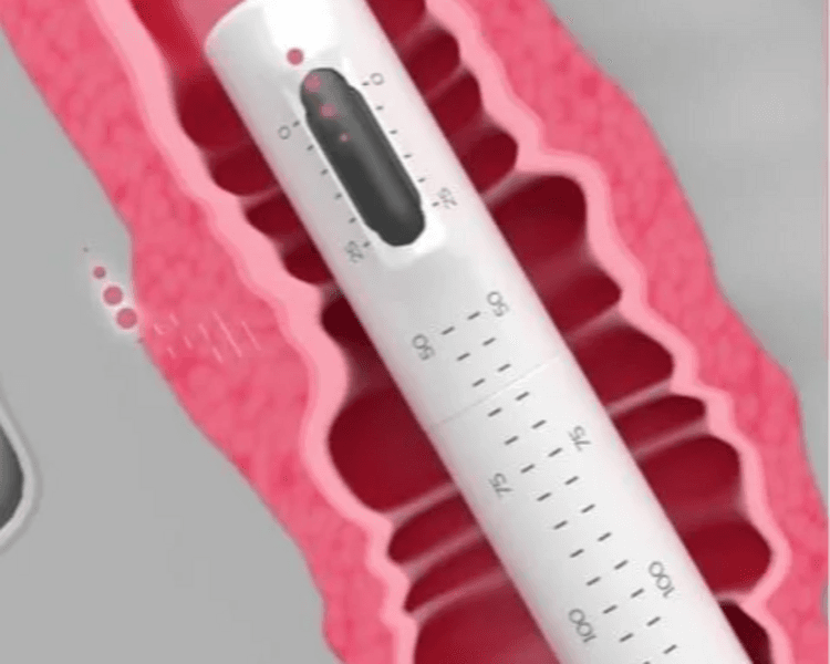 ✨HIFU Íntimo (Rejuvenecimiento Intimo✨