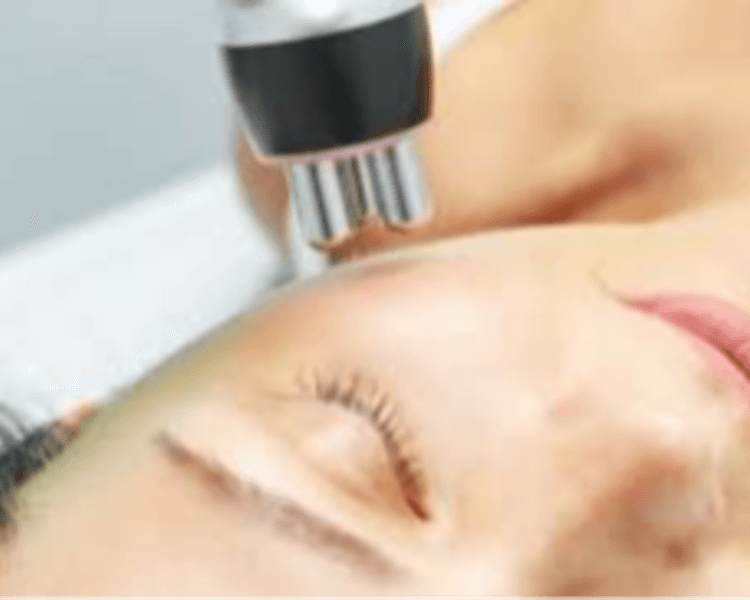 Limpieza profunda + Radiofrecuencia