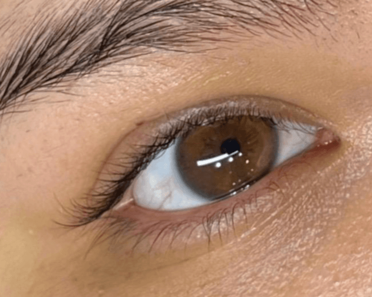 Extensiones"Clasicas"