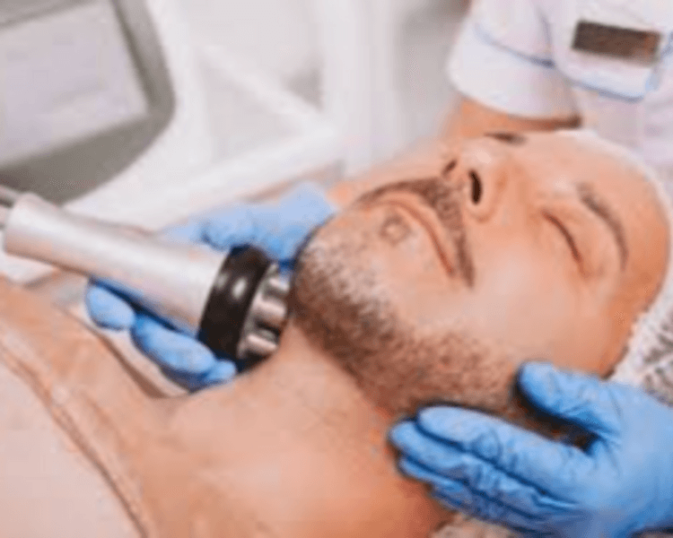 Caballeros - Limpieza profunda + Radiofrecuencia