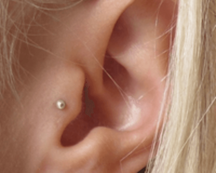 TRAGUS