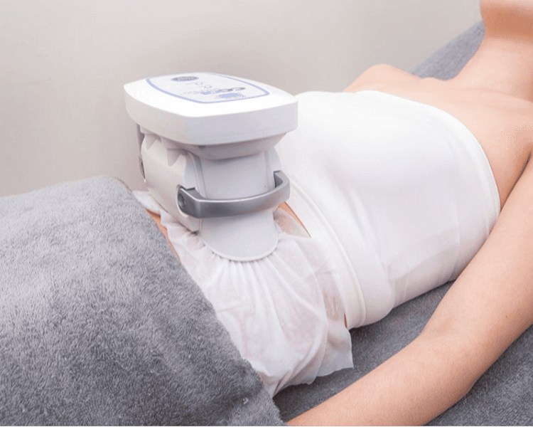 Sesión de Criolipolisis 4D (zona pequeña)