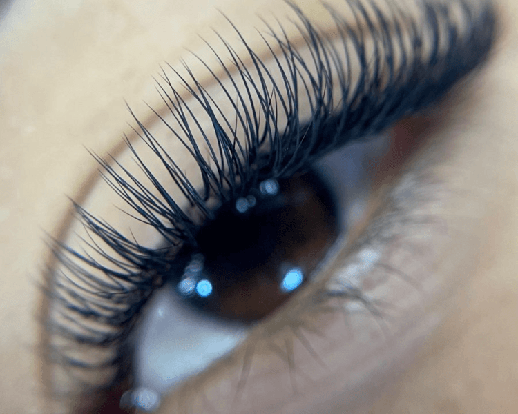 Extensiones (Seminatural)