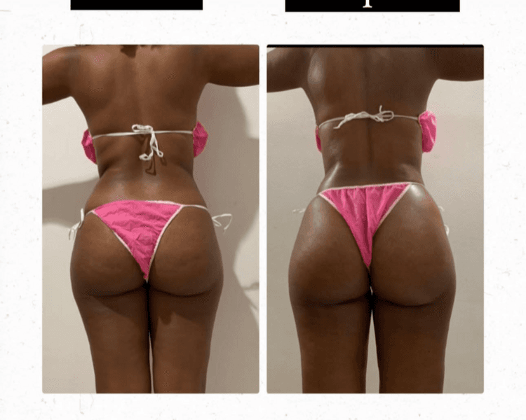 LEVANTAMIENTO DE GLUTIO 15 SESIONES