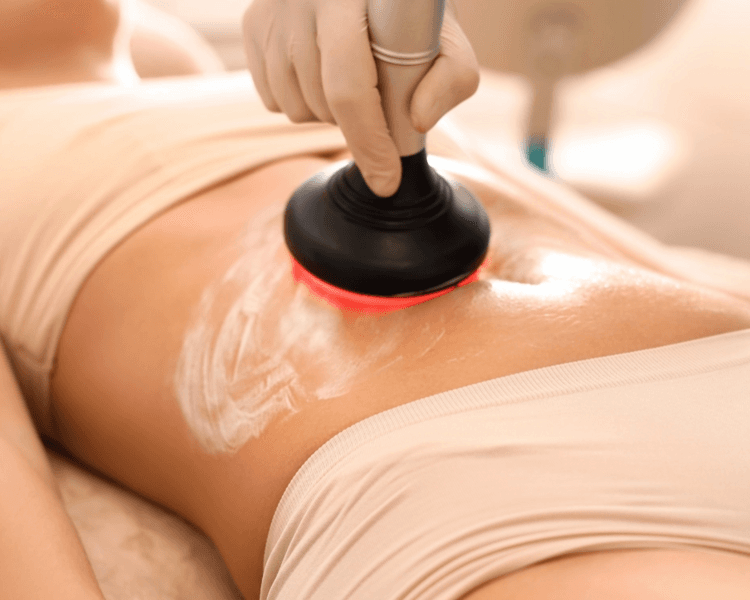 Radiofrecuencia corporal