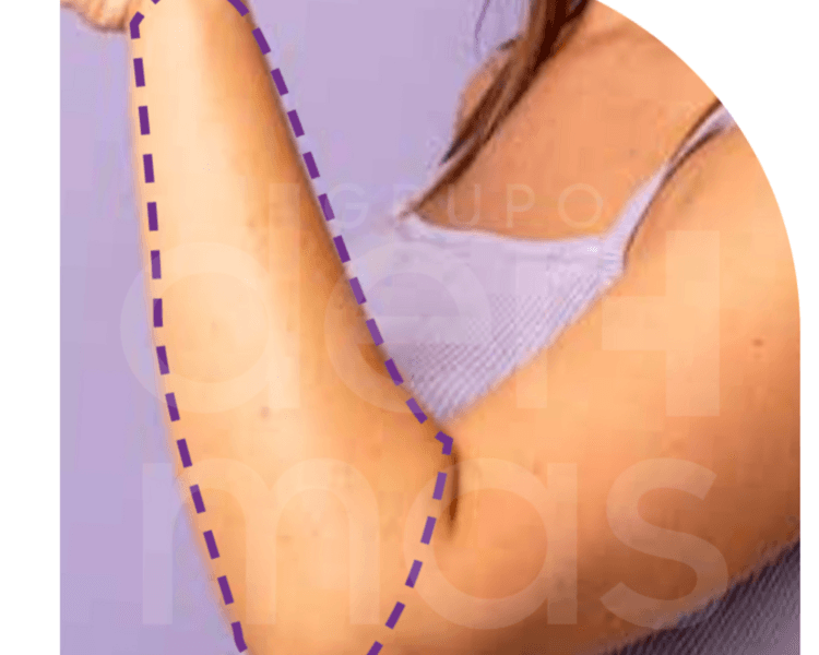 Depilación Medios Brazos