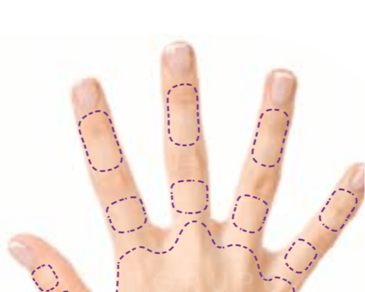 Depilación dedos manos o pies