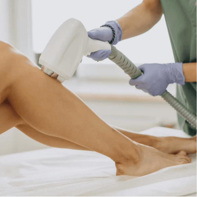 Foto de TECNICA DE DEPILACION DEFINITIVA, ELIMINACION DE TATUAJES