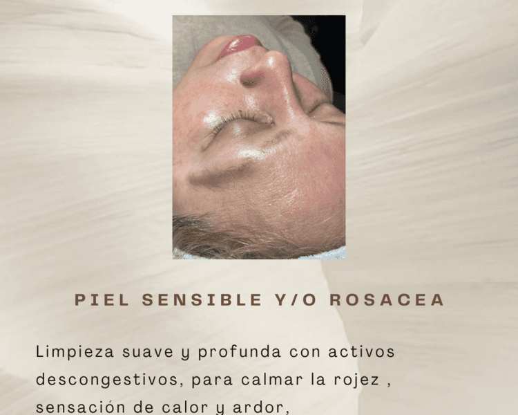 Limpieza profunda piel sensible | rosácea