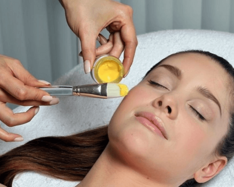 Yellow peel Despigmentante