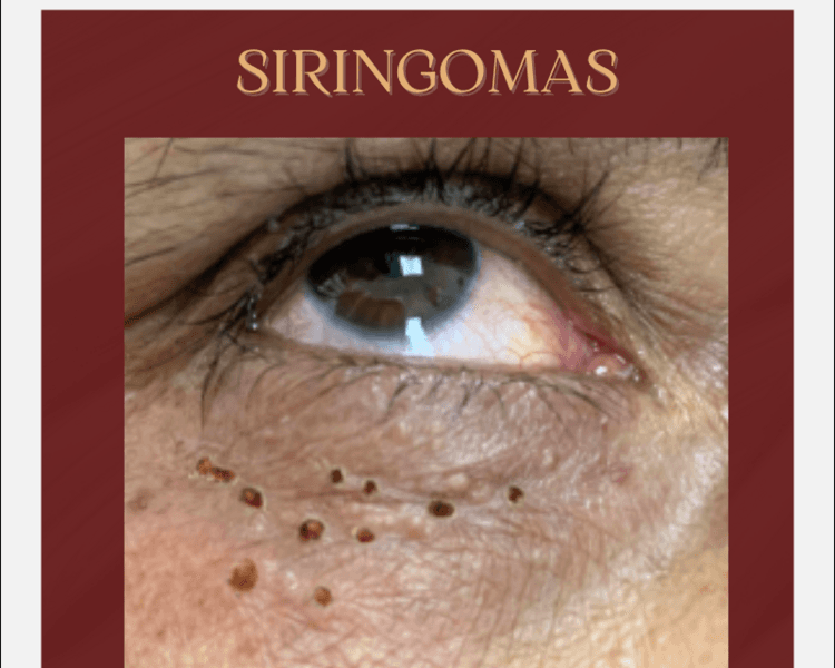 CAUTERIZACION DE 1 A 3 LESIONES