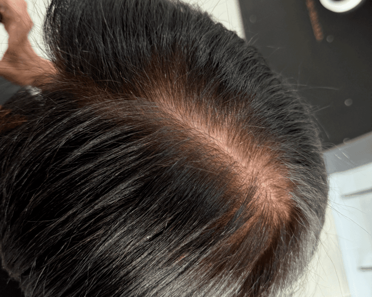 CUBRIMIENTO DE CANAS CABELLO EXTRALARGO ( CRECIMIENTO 1-2 MESES)