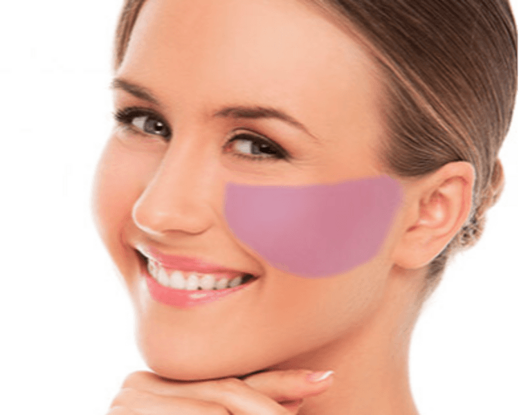 MEJILLAS Area desde final de ceja a inicio de Menton