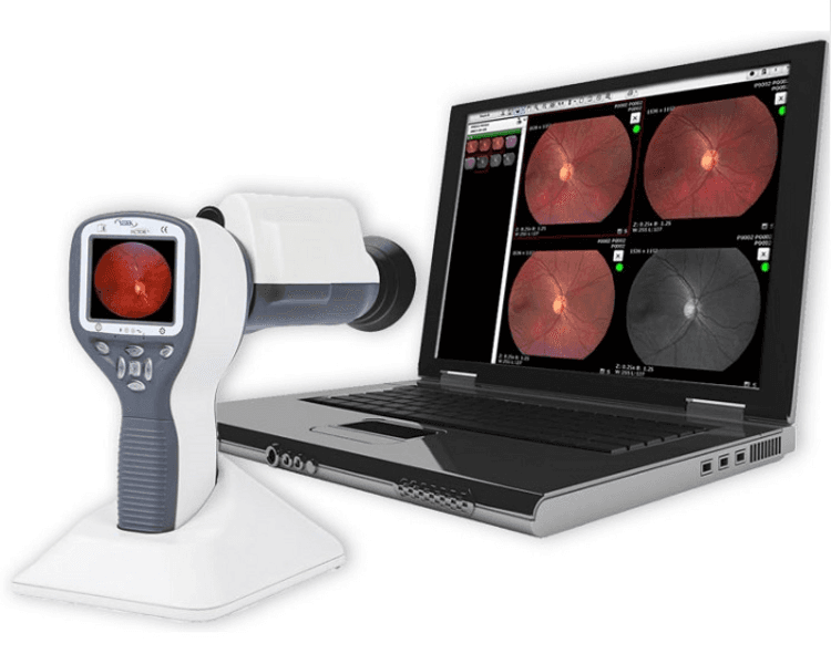 Consulta Oftalmológica