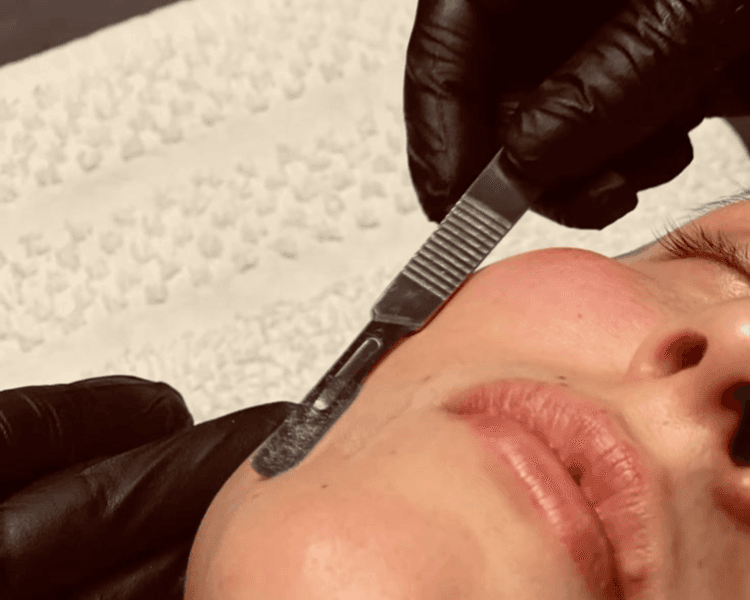 Dermaplaning Zen🌸