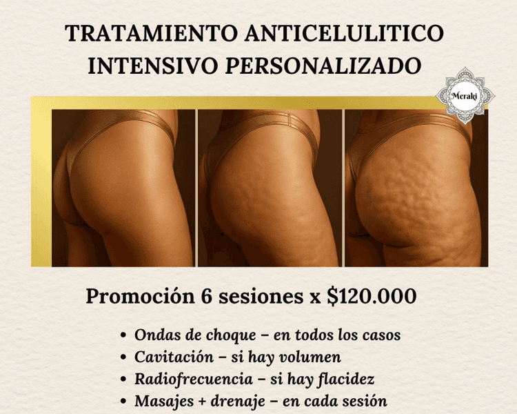 tratamiento anticelulitico intensivo personalizado