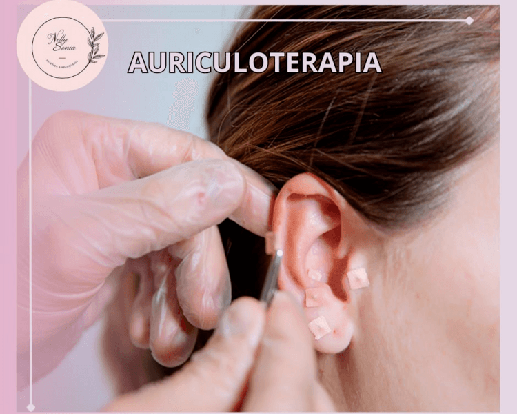 AURICULOTERAPIA